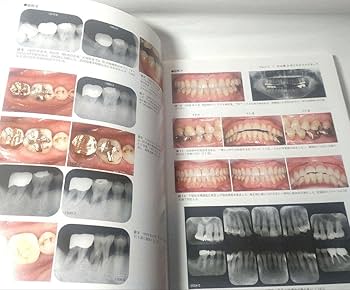 力を診る 歯列を守る力のマネジメント 市川 哲雄 森本 達也 熊谷 真一 歯科 Amazon.co.jp: 力を診る 歯列を守る力のマネジメント 市川 哲雄